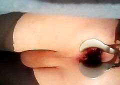 arsch dehnen mit spekulum hand im Arsch tiefe einblicke in mein Arsch hautnahe