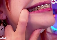 SFW Braces Elastics Close-Up