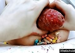 Brutal anal penetration with prolapse anal gapes