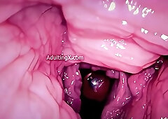 Camera in Vagina, Cervix POV, Tiny Cucked by Giant ‘Couple’, Cum in Condom and Creampie - Full Clip
