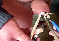 Four rubber balls and four spoons in foreskin