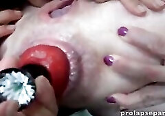 Lesbian Babes poking dildos in their interior booty funnels inside their prolapsed assholes