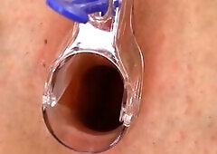 A great speculum orgasm with Alexandra
